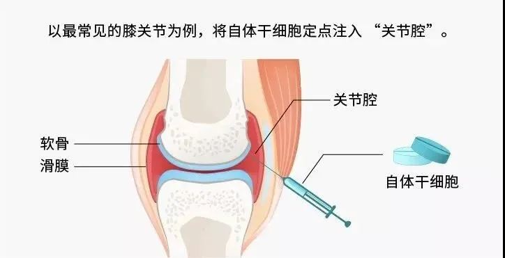 一半的致残率！这个小毛病人人值得警惕！(图7)