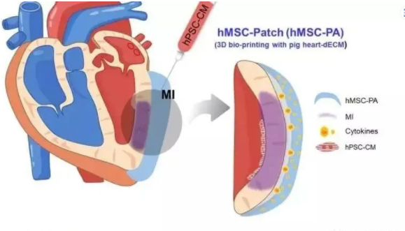 真实案例：上亿个干细胞进入心脏受损区域后，他的心脏病......(图8)